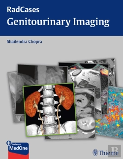 Bertrand.pt - Radcases Genitourinary Imaging