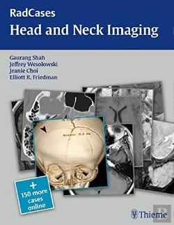Bertrand.pt - Radcases Head And Neck Imaging