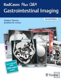 Bertrand.pt - Radcases Plus Q&A Gastrointestinal Imaging