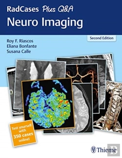 Bertrand.pt - Radcases Plus Q&A Neuro Imaging