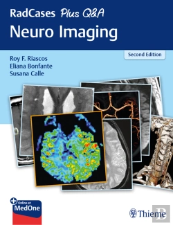 Bertrand.pt - Radcases Plus Q&A Neuro Imaging