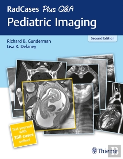 Bertrand.pt - Radcases Plus Q&A Pediatric Imaging