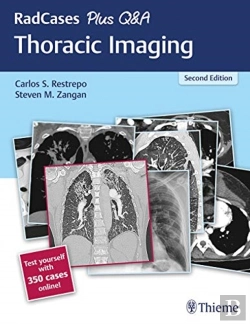 Bertrand.pt - Radcases Plus Q&A Thoracic Imaging