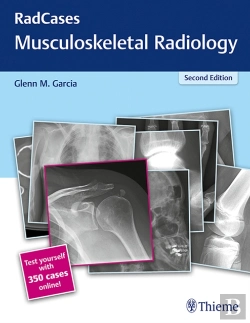Bertrand.pt - Radcases Q&A Musculoskeletal Radiology