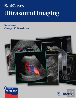 Bertrand.pt - Radcases Ultrasound Imaging