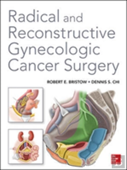 Bertrand.pt - Radical And Reconstructive Gynecologic Cancer Surgery