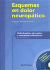 Radiculopat¡As, Plexopat¡As Y Neuropat¡As Inflamatorias