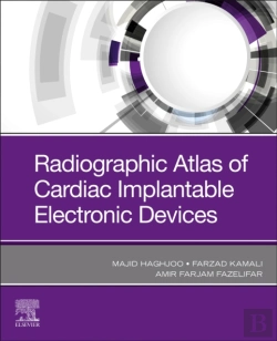 Bertrand.pt - Radiographic Atlas Of Cardiac Implantable Electronic Devices