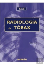 Radiologia Del Torax