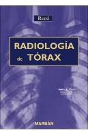 Radiologia Del Torax