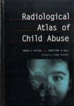 Bertrand.pt - Radiological Atlas Of Child Abuse