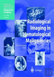 Radiological Imaging In Hematological Malignancies