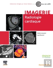 Radiologie Cardiaque