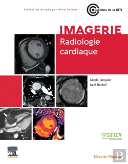 Bertrand.pt - Radiologie Cardiaque