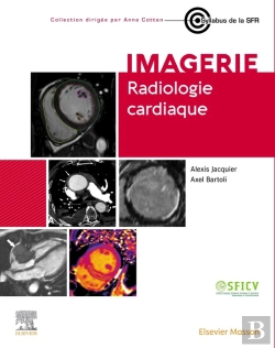 Bertrand.pt - Radiologie Cardiaque