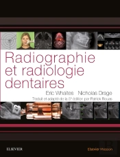Radiologie Dentaire