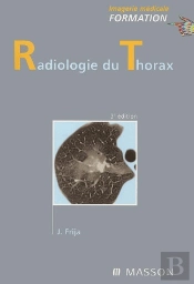 Radiologie Du Thorax (3e Édition)