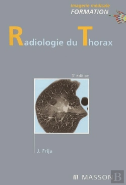 Bertrand.pt - Radiologie Du Thorax (3e Édition)