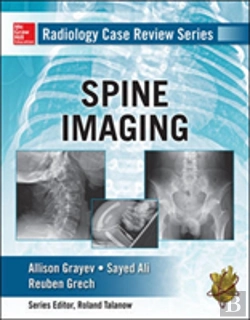 Bertrand.pt - Radiology Case Review Series: Spine