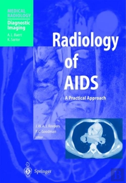 Bertrand.pt - Radiology Of Aids