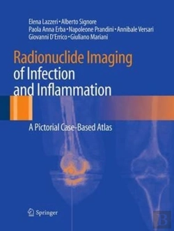 Bertrand.pt - Radionuclide Imaging Of Infection And Inflammation
