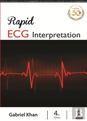 Rapid Ecg Interpretation