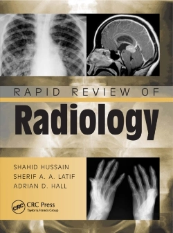 Bertrand.pt - Rapid Review Of Radiology
