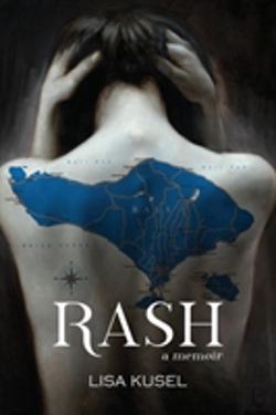 Bertrand.pt - Rash