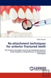 Re-Attachment Techniques For Anterior Fr