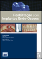 Reabilitação com Implantes Endo-Ósseos