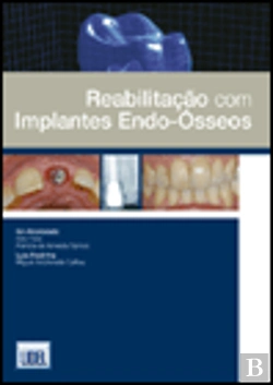 Bertrand.pt - Reabilitação com Implantes Endo-Ósseos