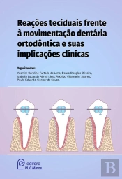 Reações Teciduais Frente À Movimentação Dentária Ortodóntica E Suas Implicações Clínicas