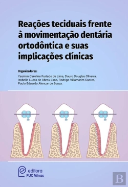 Bertrand.pt - Reações Teciduais Frente À Movimentação Dentária Ortodóntica E Suas Implicações Clínicas