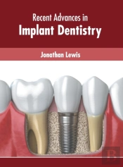 Recent Advances In Implant Dentistry