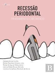 Recessão Periodontal