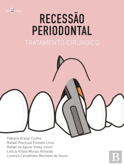Bertrand.pt - Recessão Periodontal