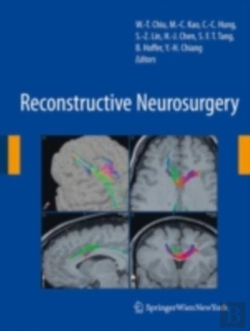 Bertrand.pt - Reconstructive Neurosurgery