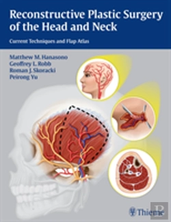 Bertrand.pt - Reconstructive Plastic Surgery Of The Head And Neck