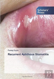 Recurrent Aphthous Stomatitis