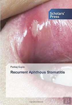 Bertrand.pt - Recurrent Aphthous Stomatitis