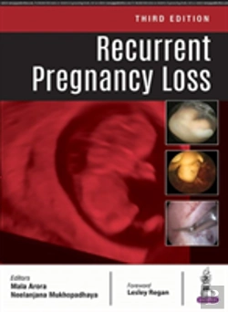 Bertrand.pt - Recurrent Pregnancy Loss