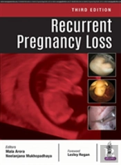 Recurrent Pregnancy Loss
