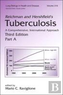 Reichman And Hershfield'S Tuberculosis