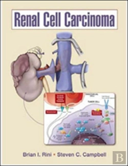 Bertrand.pt - Renal Cell Carcinoma