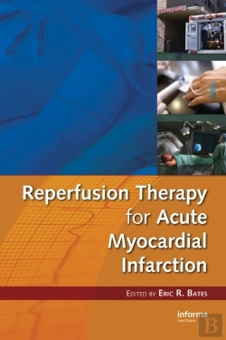 Bertrand.pt - Reperfusion Therapy For Acute Myocardial Infarction