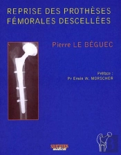 Reprise Des Prothèses Fémorales Descellées