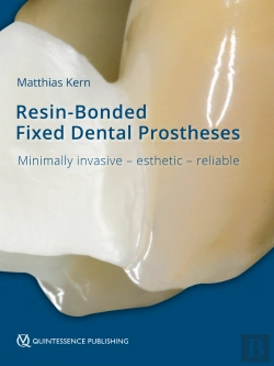 Bertrand.pt - Resin-Bonded Fixed Dental Prostheses