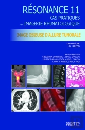 Resonance 11 - Imagerie Osseuse D'Allure Tumorale - Cas Pratiques En Imagerie Musculosquelettique