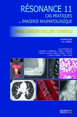 Bertrand.pt - Resonance 11 - Imagerie Osseuse D'Allure Tumorale - Cas Pratiques En Imagerie Musculosquelettique