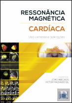 Ressonância Magnética Cardíaca